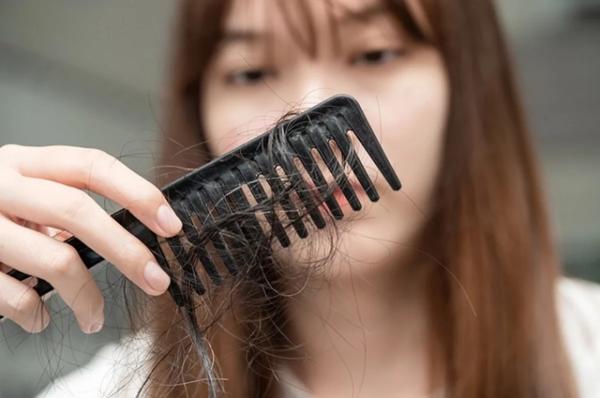 Adelgazar puede provocar calvicie: los científicos advierten que una dieta de moda provoca la caída del cabello