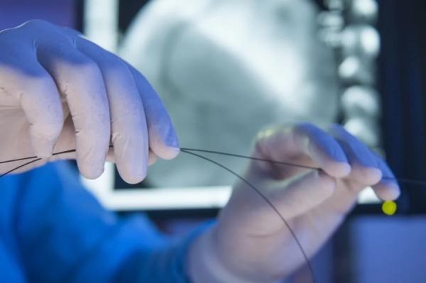 
        El resorte de la vida. El cirujano Grigorian explicó si se deben cambiar y limpiar los stents    