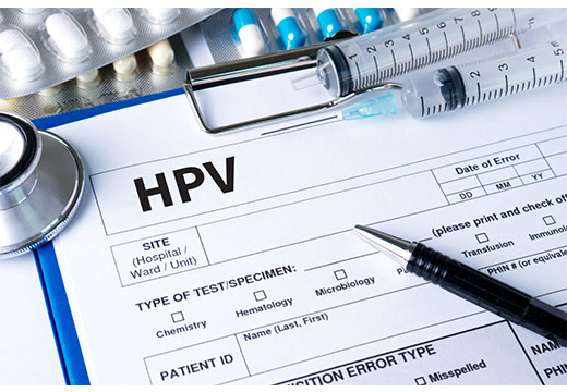 Ventajas y desventajas de la prueba digene para detectar cepas de VPH